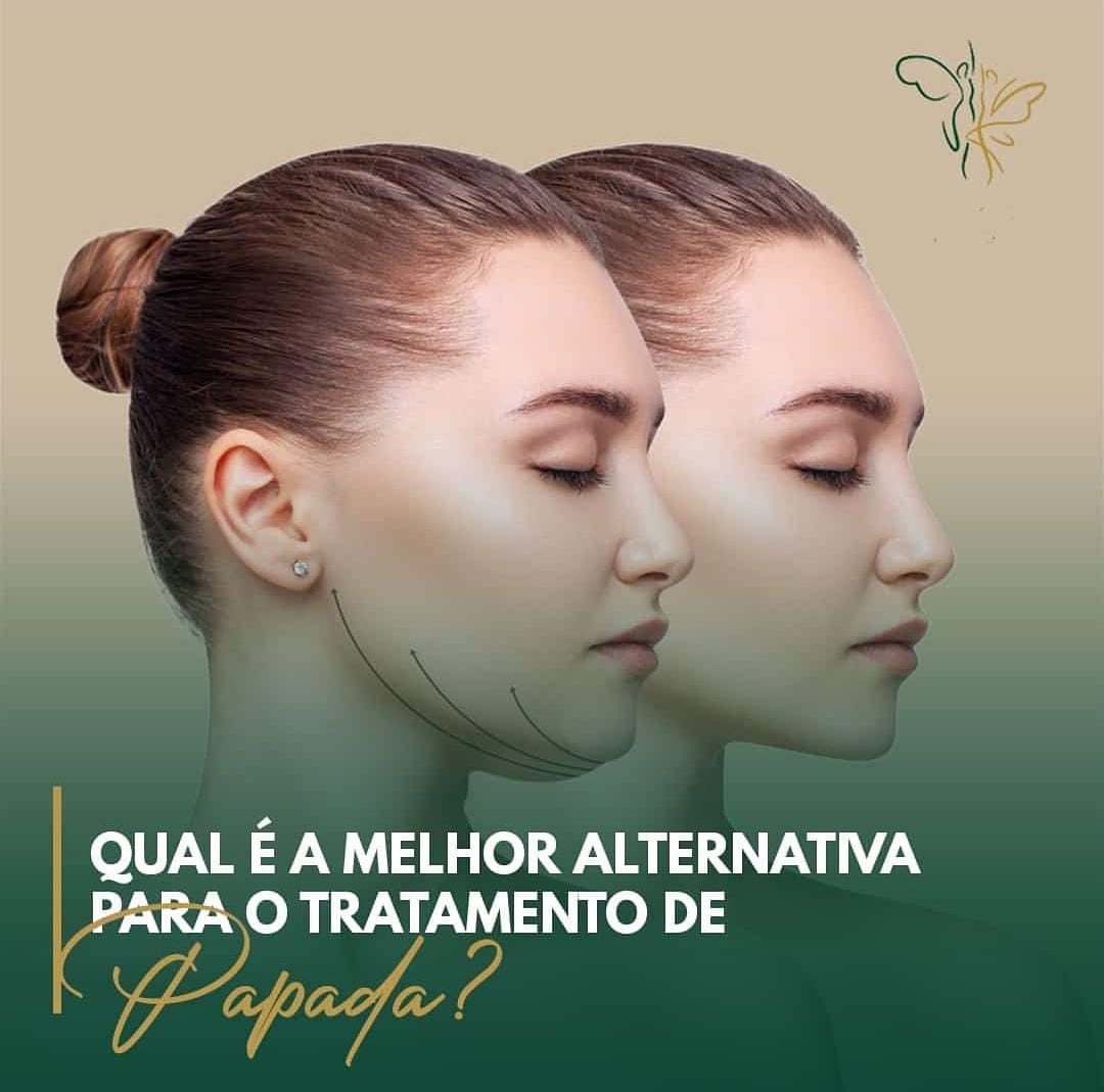 Melhor-Alternativa-Tratamento-de-Papada-1.jpeg