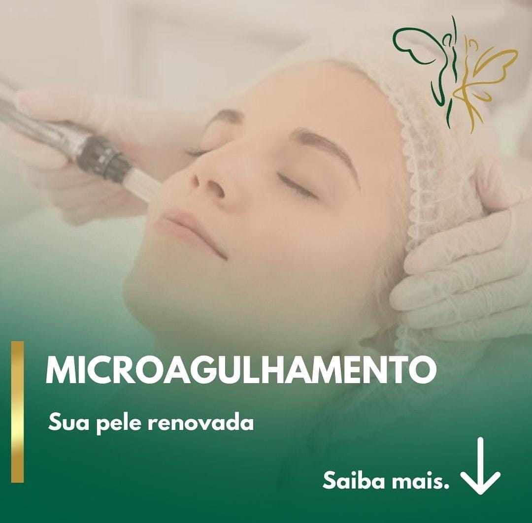 Microagulhamento.jpeg