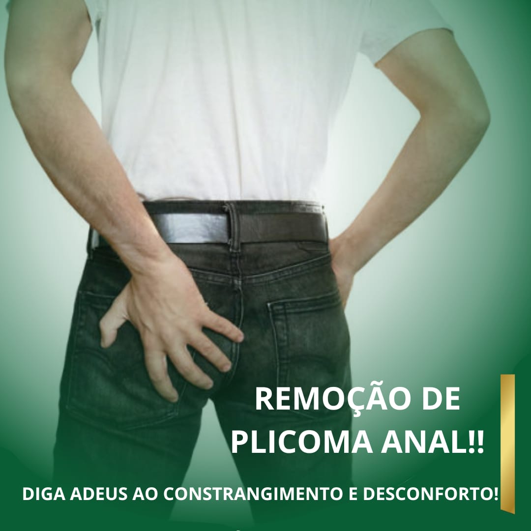 Remocao-de-Plicoma-Anal-Man.jpeg